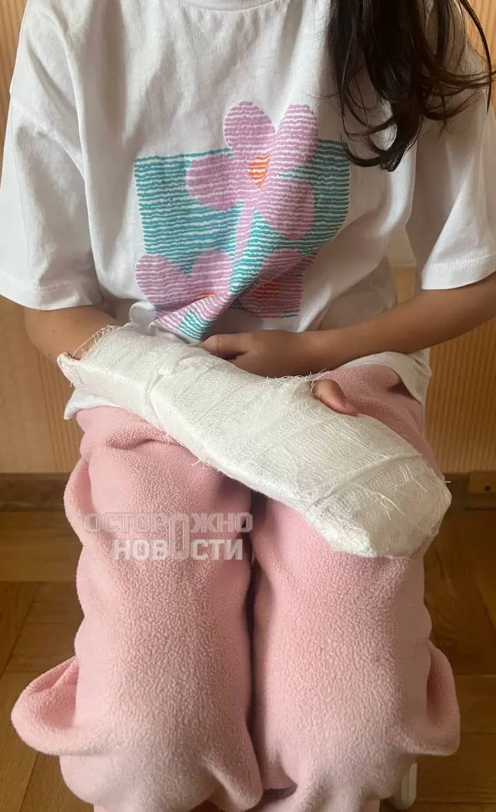 Двое курсантов МЧС на одном электросамокате сбили восьмилетнюю девочку на тротуаре и скрылись. Пострадавшая получила открытый перелом руки, полиция молчит уже месяц после обращения.