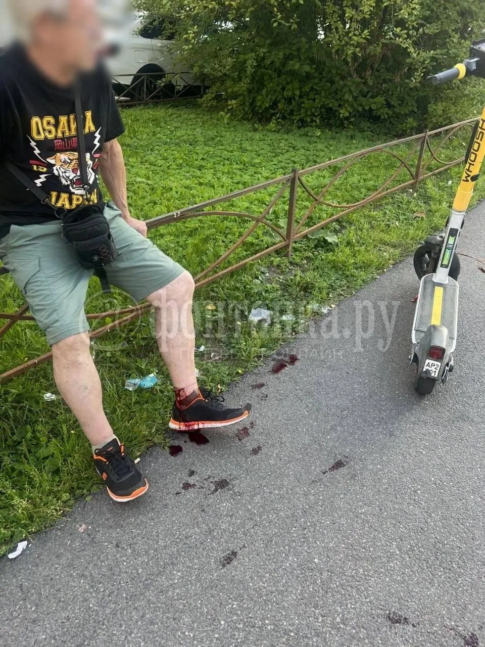 Пенсионер получил глубокую рану на ноге; оказана медицинская помощь, пострадавшего выписали из больницы. Расследование продолжается.